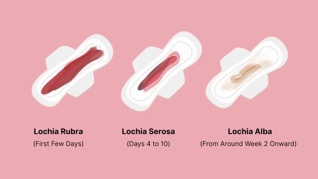 What Is Postpartum Bleeding?